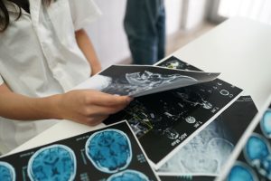 Може ли човек да се възстанови напълно след инсулт